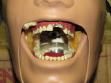 Dental School X-Ray Teaching Trainer Dentsply RINN DXTTR III MANNEQUIN Natural Head 54/6001