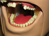 Dental School X-Ray Teaching Trainer Dentsply RINN DXTTR III MANNEQUIN Natural Head 54/6001