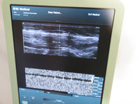 BK B-K Medical 1202 Ultrasound Flex Focus 400 - Works Great!