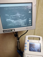 Sonosite 180 Plus, Docking Station, Printer Monitor, L38 Transducer, new battery