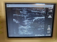 Sonosite 180 Plus, Docking Station, Printer Monitor, L38 Transducer, new battery