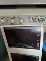 Sonosite 180 Plus, Docking Station, Printer Monitor, L38 Transducer, new battery