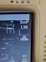 Sonosite 180 Plus, Docking Station, Printer Monitor, L38 Transducer, new battery