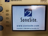 Sonosite 180 Plus, Docking Station, Printer Monitor, L38 Transducer, new battery