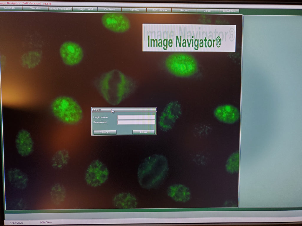 Immunoconcepts Image Navigator Automated Microscope IFA testing system ...