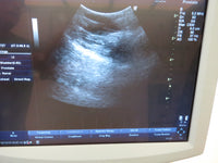 2008 GE LOGIQ P5 Ultrasound System with 3.5C Transducer & Printer