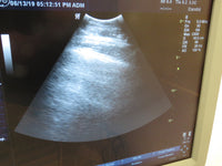2008 GE LOGIQ P5 Ultrasound System with 3.5C Transducer & Printer