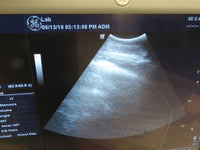 2008 GE LOGIQ P5 Ultrasound System with 3.5C Transducer & Printer