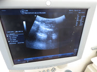 2010 GE LOGIQ P5 Ultrasound System with 4C Transducer & Printer