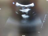 2018 Philips Affiniti 70W OB/GYN Ultrasound System w/ 4 Transducers - Exceptional Condition!