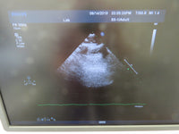 2010 Philips IE33 Ultrasound System w/ 3 Transducers