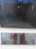 2010 Philips IE33 Ultrasound System w/ 3 Transducers