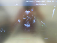 2010 Philips IE33 Ultrasound System w/ 3 Transducers