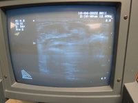 B-K Medical REF Type 8811 5-12MHz MFI transducer - fits Falcon 2101 Ultrasound - TESTED!