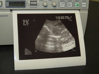 Sony UP-897MD Black and White Video Printer For Ultrasound Printing - Exceptional Condition!