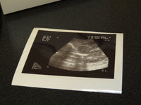 Sony UP-897MD Black and White Video Printer For Ultrasound Printing - Exceptional Condition!