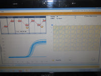 Illumina Eco Real-Time PCR System with Laptop & Version 5 Control/Study Software