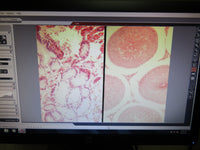 Dual Leica DM2500 Microscopes w/ FS4000 Forensic Bridge HCX PL FLUOTAR Objectives + Camera