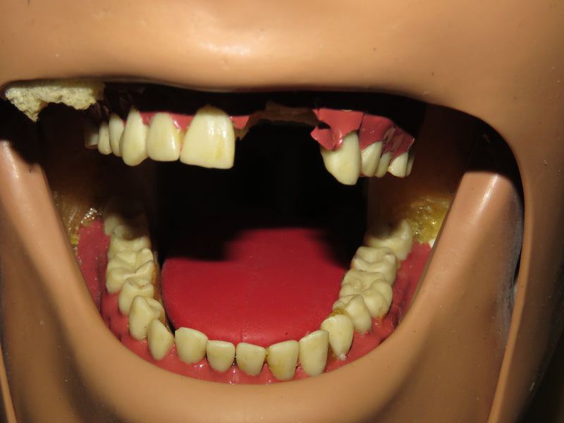 Dental School X-Ray Teaching Trainer Dentsply RINN DXTTR III MANNEQUIN ...