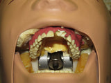 Dental School X-Ray Teaching Trainer Dentsply RINN DXTTR III MANNEQUIN Natural Head 54/6001