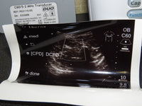 Sonosite 180 Plus, Docking Station, Printer Monitor, C60, L38, L25 Transducers, New battery