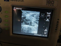 Sonosite 180 Plus, Docking Station, Printer Monitor, C60, L38, L25 Transducers, New battery