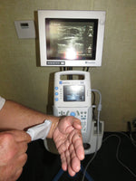 Sonosite 180 Plus, Docking Station, Printer Monitor, C60, L38, L25 Transducers, New battery