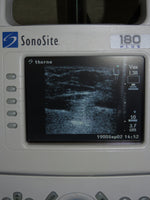 Sonosite 180 Plus, Docking Station, Printer Monitor, C60, L38, L25 Transducers, New battery