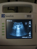 Sonosite 180 Plus, Docking Station, Printer Monitor, C60, L38, L25 Transducers, New battery